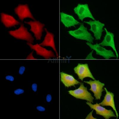 Melatonin Receptor 1A Antibody - DF13877 staining A549 cells by IF/ICC.
