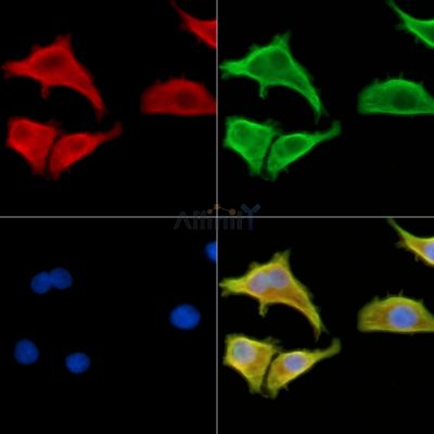 calcyphosine Antibody - DF13955 staining HepG2 cells by IF/ICC.