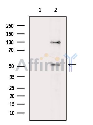TRIM17 Antibody - Western blot analysis of extracts from RAW264.