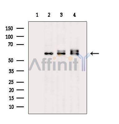 CSN1 Antibody - Western blot analysis of extracts from various samples, using CSN1 Antibody.