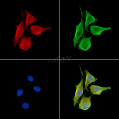 LIME Antibody - DF13967 staining HepG2 cells by IF/ICC.