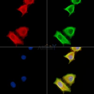 TLR10 Antibody - DF13970 staining HepG2 cells by IF/ICC.