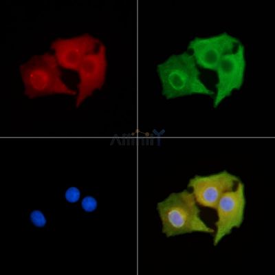 GPCR TGR5 Antibody - DF14067 staining A549 cells by IF/ICC.
