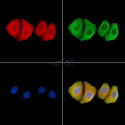 Dact2 Antibody - DF14081 staining Hela cells by IF/ICC.