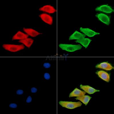 LARP1 Antibody - DF14113 staining HepG2 cells by IF/ICC.