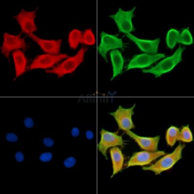 CRYBA4 Antibody - DF14158 staining HepG2 cells by IF/ICC.