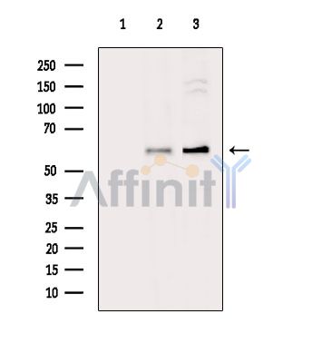 CPNE3 Antibody - Western blot analysis of extracts from various samples, using CPNE3 Antibody.