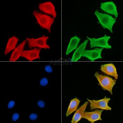 RDH5 Antibody - DF14183 staining HepG2 cells by IF/ICC.