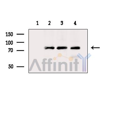 LRFN5 Antibody - Western blot analysis of extracts from various samples, using LRFN5 Antibody.