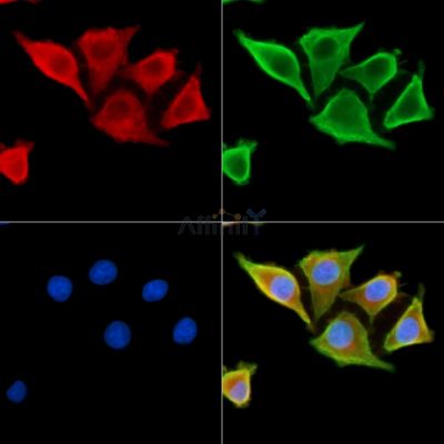 SCARA5 Antibody - DF14221 staining HepG2 cells by IF/ICC.