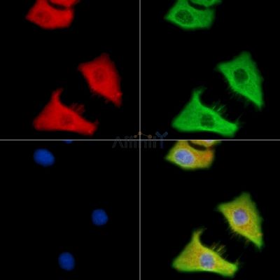 C12orf29 Antibody - DF14227 staining HepG2 cells by IF/ICC.