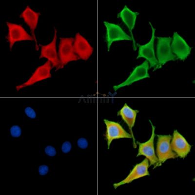 GLCCI1 Antibody - DF14228 staining HepG2 cells by IF/ICC.