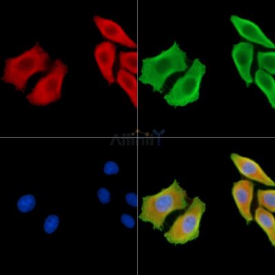 Melanoma Inhibitory Activity Antibody - DF14235 staining HepG2 cells by IF/ICC.