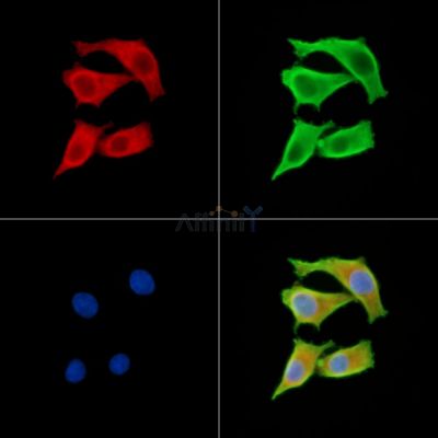 AGRP Antibody - DF14244 staining HepG2 cells by IF/ICC.