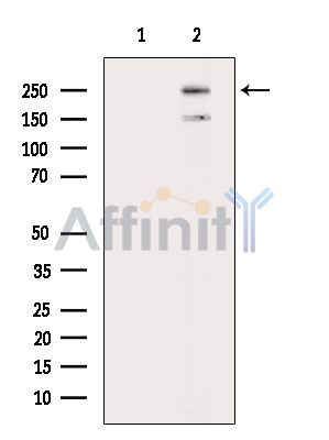 KMT2G/hSET1B Antibody - Western blot analysis of extracts from MC-3T3-E1 cells(H2O2 treatment), using KMT2G/hSET1B Antibody.