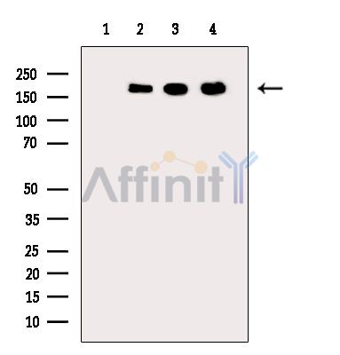 ATAD2 Antibody - Western blot analysis of extracts from various samples, using ATAD2 Antibody.