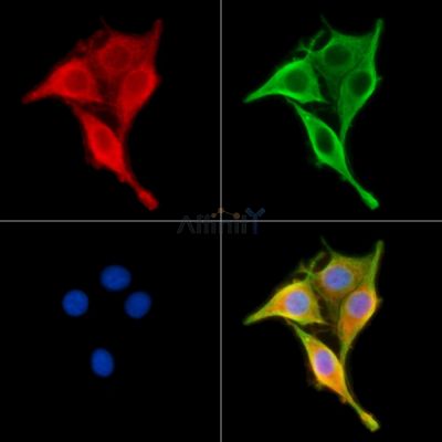 PP11 Antibody - DF14256 staining HepG2 cells by IF/ICC.