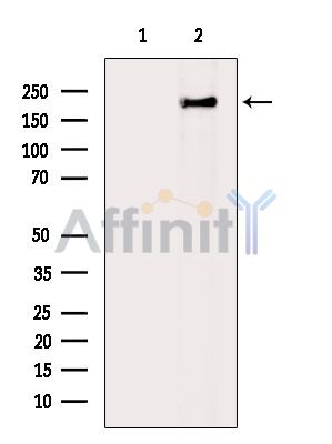 KIF21B Antibody - Western blot analysis of extracts from Mouse brain, using KIF21B Antibody.