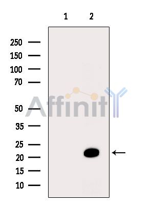 Amelotin Antibody - Western blot analysis of extracts from Mouse brain, using Amelotin Antibody.