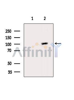 ZNRF3 Antibody - Western blot analysis of extracts from Mouse brain, using ZNRF3 Antibody.