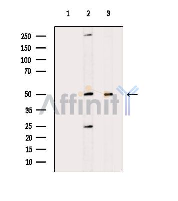 CPA3 Antibody - Western blot analysis of extracts from various samples, using CPA3 Antibody.