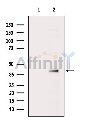 SNX16 Antibody - Western blot analysis of extracts from Mouse brain, using SNX16 Antibody.