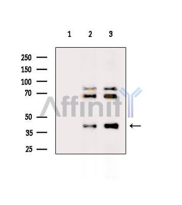 PPME1 Antibody - Western blot analysis of extracts from various samples, using PPME1 Antibody.