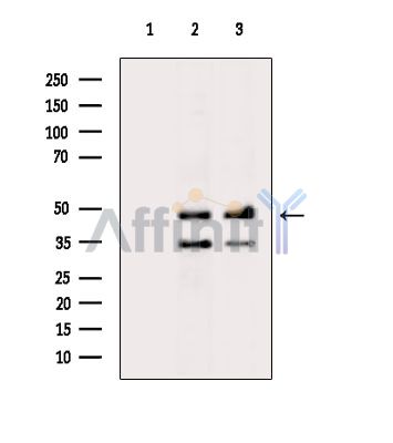 AP2 alpha Antibody - Western blot analysis of extracts from various samples, using AP2 alpha Antibody.
