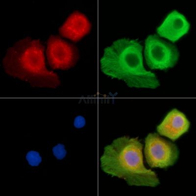 PIK3R3 Antibody - DF2629 staining Hela cells by IF/ICC.