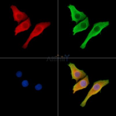 SRMS Antibody - DF2682 staining Hela cells by IF/ICC.