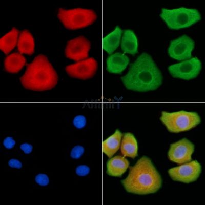 HOR5'Beta13 Antibody - DF2718 staining Hela cells by IF/ICC.