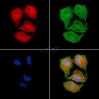 MIA2 Antibody - DF4156 staining A549 cells by IF/ICC.