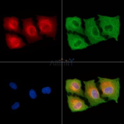 Tensin-2 Antibody - DF8623 staining A549 cells by IF/ICC.