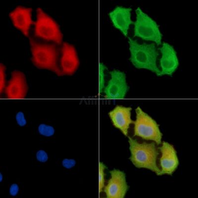 Trypsin-3 Antibody - DF8625 staining A549 cells by IF/ICC.