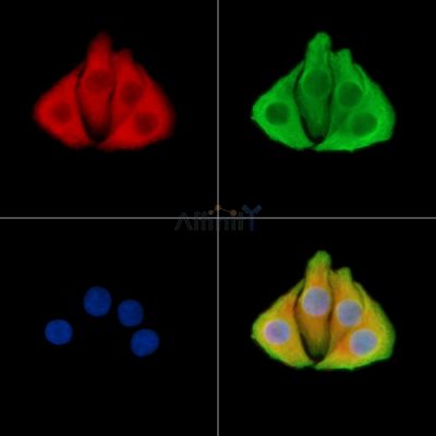 TAL2 Antibody - DF8832 staining Hela cells by IF/ICC.