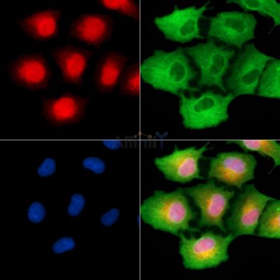 CHRC1 Antibody - DF8875 staining A549 cells by IF/ICC.