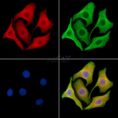Collagen VII  alpha 1 Antibody - DF8901 staining Hela cells by IF/ICC.