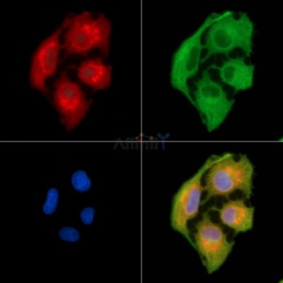 K1HB Antibody - DF9007 staining A549 cells by IF/ICC.