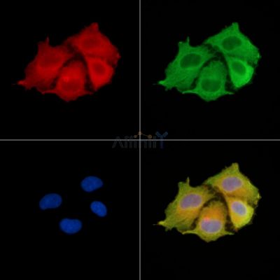 KRT81 Antibody - DF9012 staining A549 cells by IF/ICC.