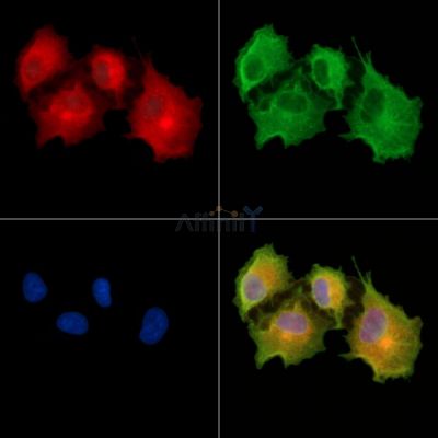 NFAM1 Antibody - DF9026 staining A549 cells by IF/ICC.