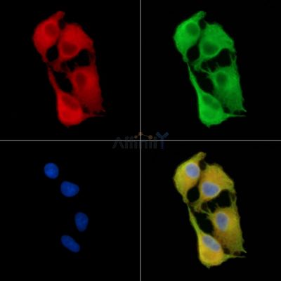 TUBE1 Antibody - DF9034 staining A549 cells by IF/ICC.