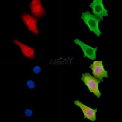 TNIP3 Antibody - DF9083 staining Hela cells by IF/ICC.