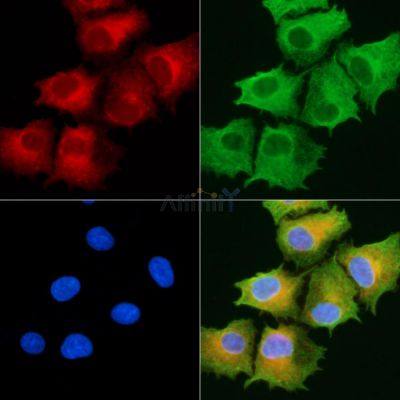 ABHD10 Antibody - DF9141 staining A549 cells by IF/ICC.