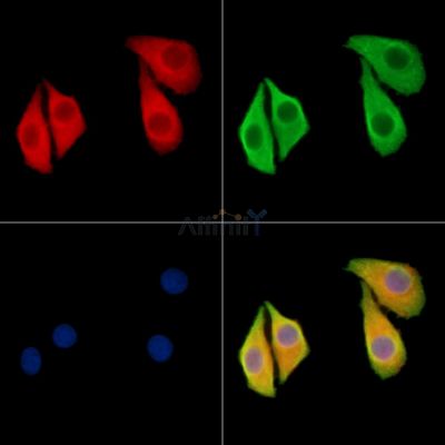 CAPN13 Antibody - DF9319 staining Hela cells by IF/ICC.