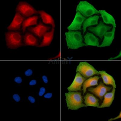 CA10 Antibody - DF9334 staining A549 cells by IF/ICC.