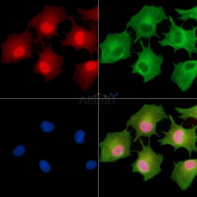 CGRRF1 Antibody - DF9357 staining A549 cells by IF/ICC.