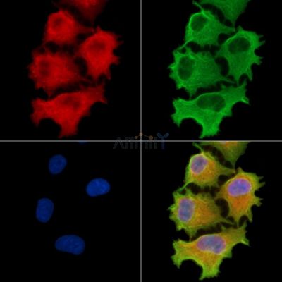 CEP41 Antibody - DF9362 staining A549 cells by IF/ICC.