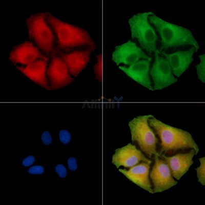 CLCNKB Antibody - DF9376 staining A549 cells by IF/ICC.