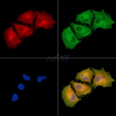 CNDP2 Antibody - DF9428 staining A549 cells by IF/ICC.
