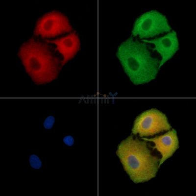 DHRS11 Antibody - DF9436 staining A549 cells by IF/ICC.